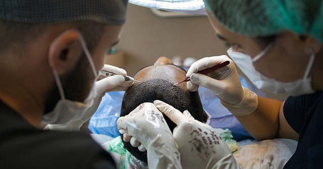 Hårtransplantation i Istanbul: En revolutionerende løsning på hårtab